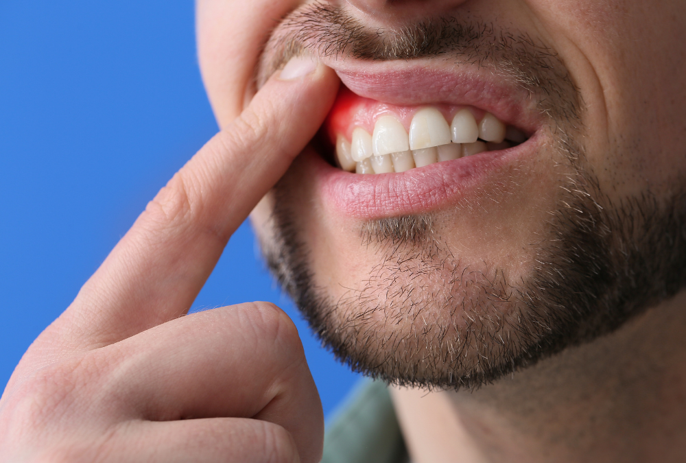 Periodontal Disease: Causes, Symptoms, And Treatment